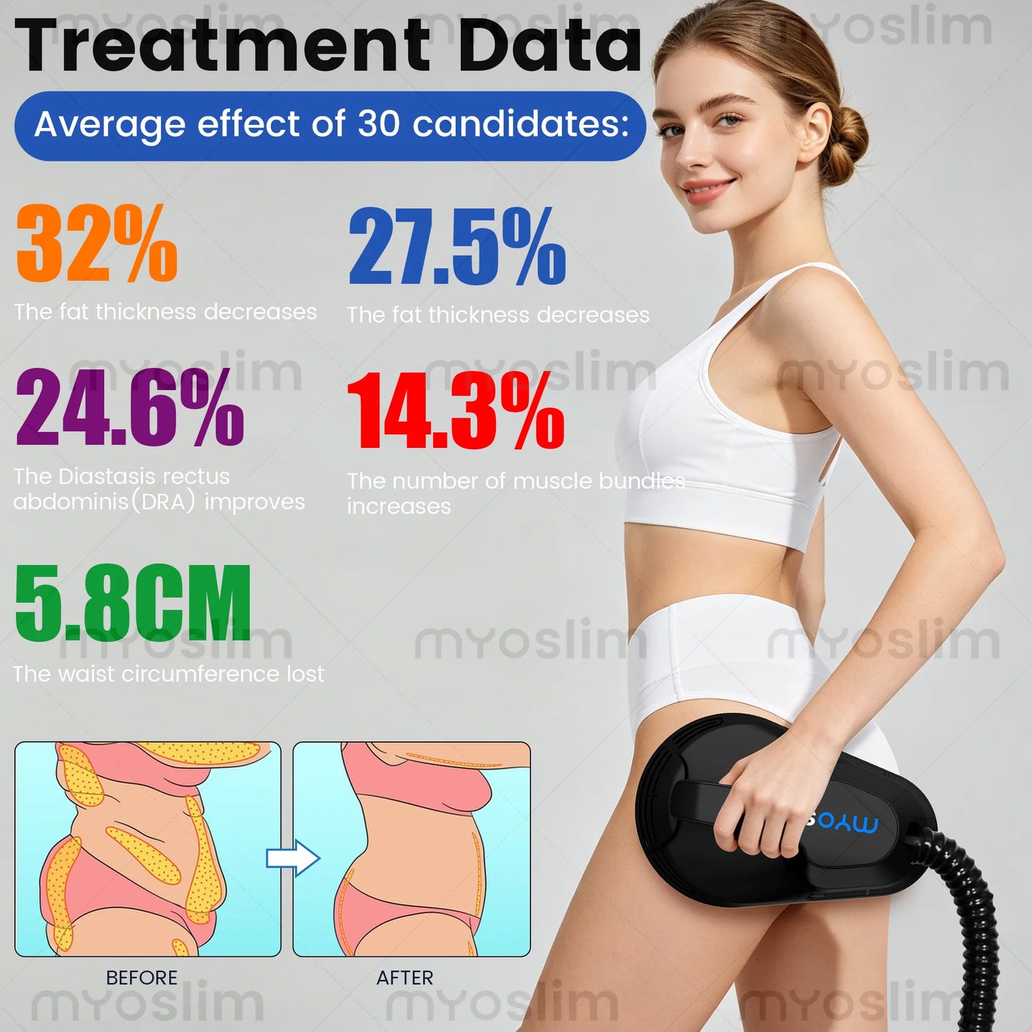 Myoslim Advanced EMS RF Body Sculpting Device For Fitness