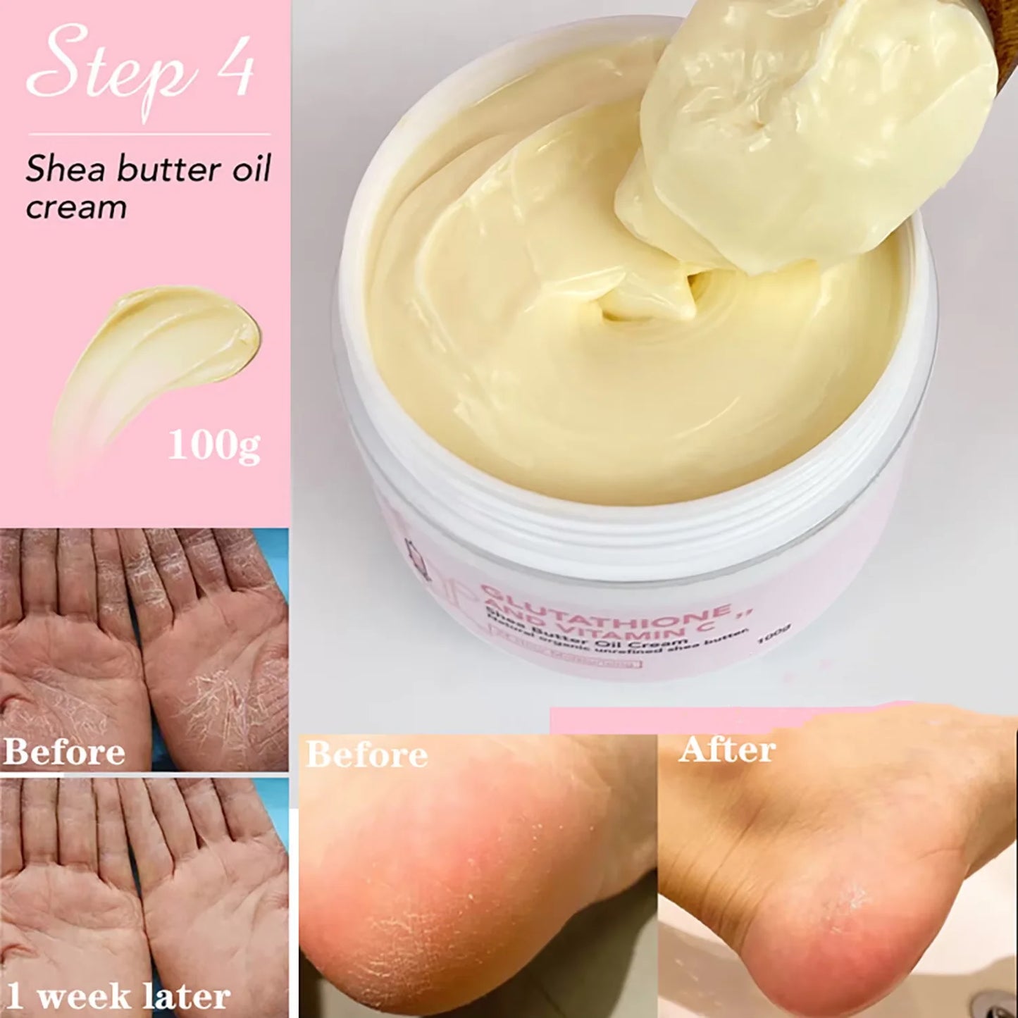 AILKE Whitening Face And Body Moisturizing Shea Butter Cream